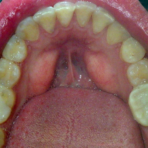 Invisalign Dentist Michigan